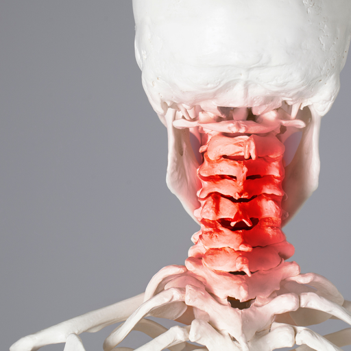 Relever le défi de la Cervicobrachialgie : Du diagnostic à la prise en charge (2025-05-01 - 2025-08-01)