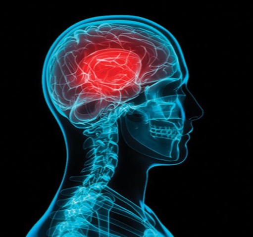 Managing Sport-Related Concussions in Children and Adolescents (2025-05-01 - 2025-08-01)