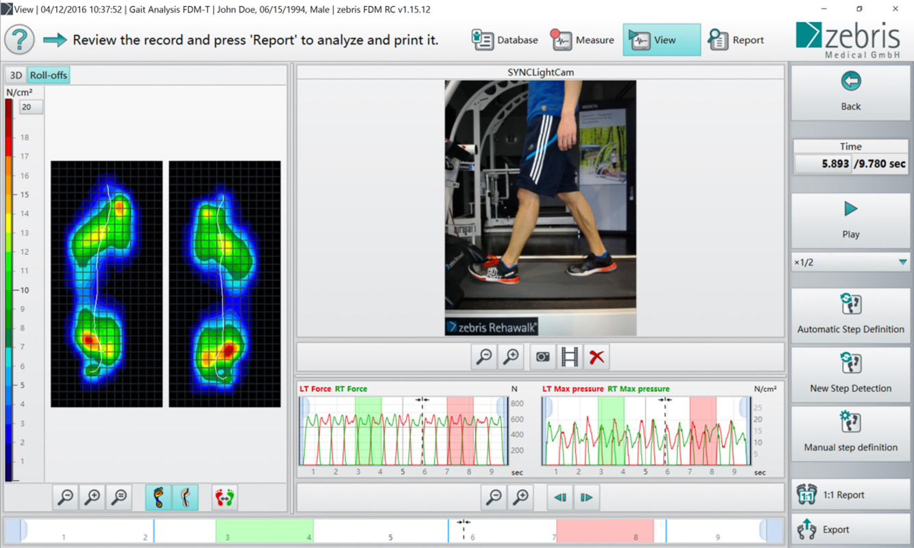 Logiciel d’analyse de la charge en position debout pour plaque fixe