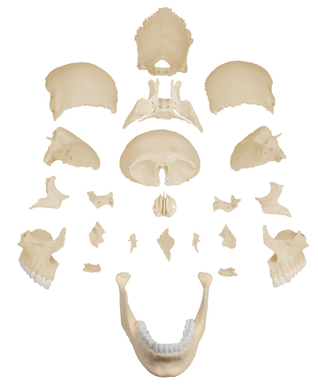 Modèle - Crâne humain éclaté en 22 pièces, à la Beauchêne
