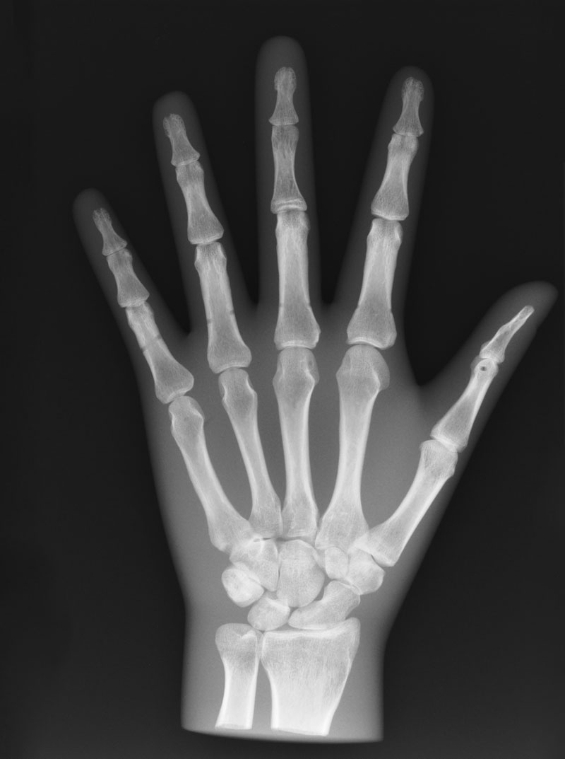 Modèle de main fantôme pour rayon-x