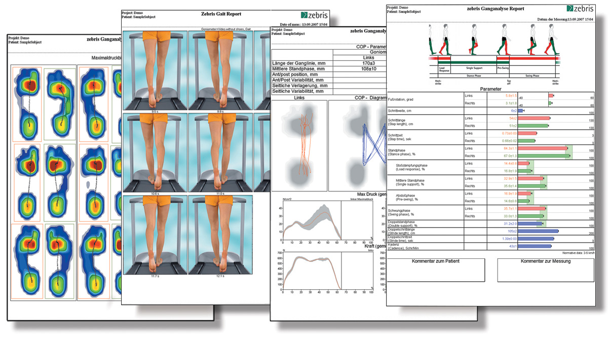 Plateforme d’analyse de la marche FDM - new