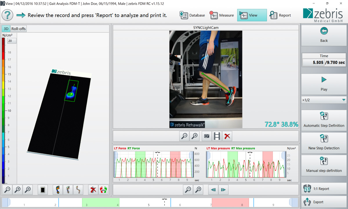 Logiciel pour l’analyse de la charge en position debout.