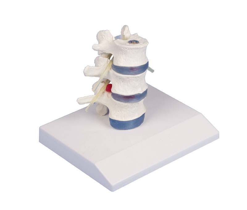Anatomical model - Lumbar vertebra model
