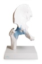 Functional Hip with clear joint