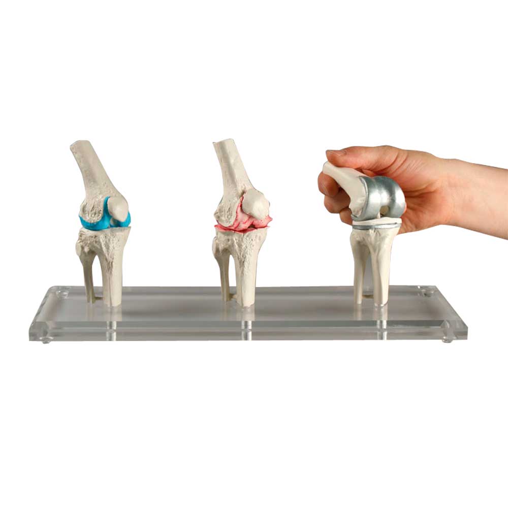 Set of three (3) knee models