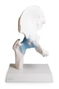[116-287] Functional Hip with clear joint
