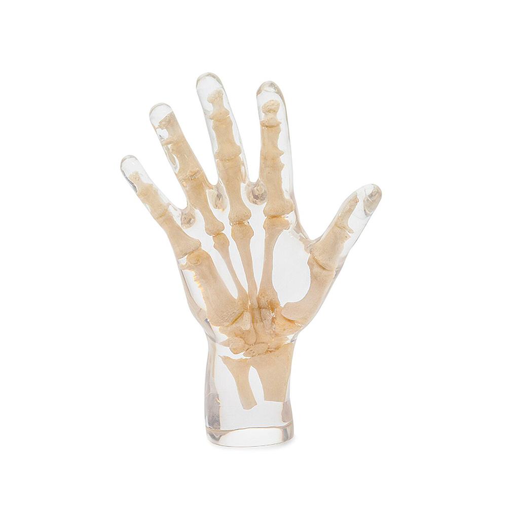 [117-665] Model - Radiology test phantom - Hand and wrist