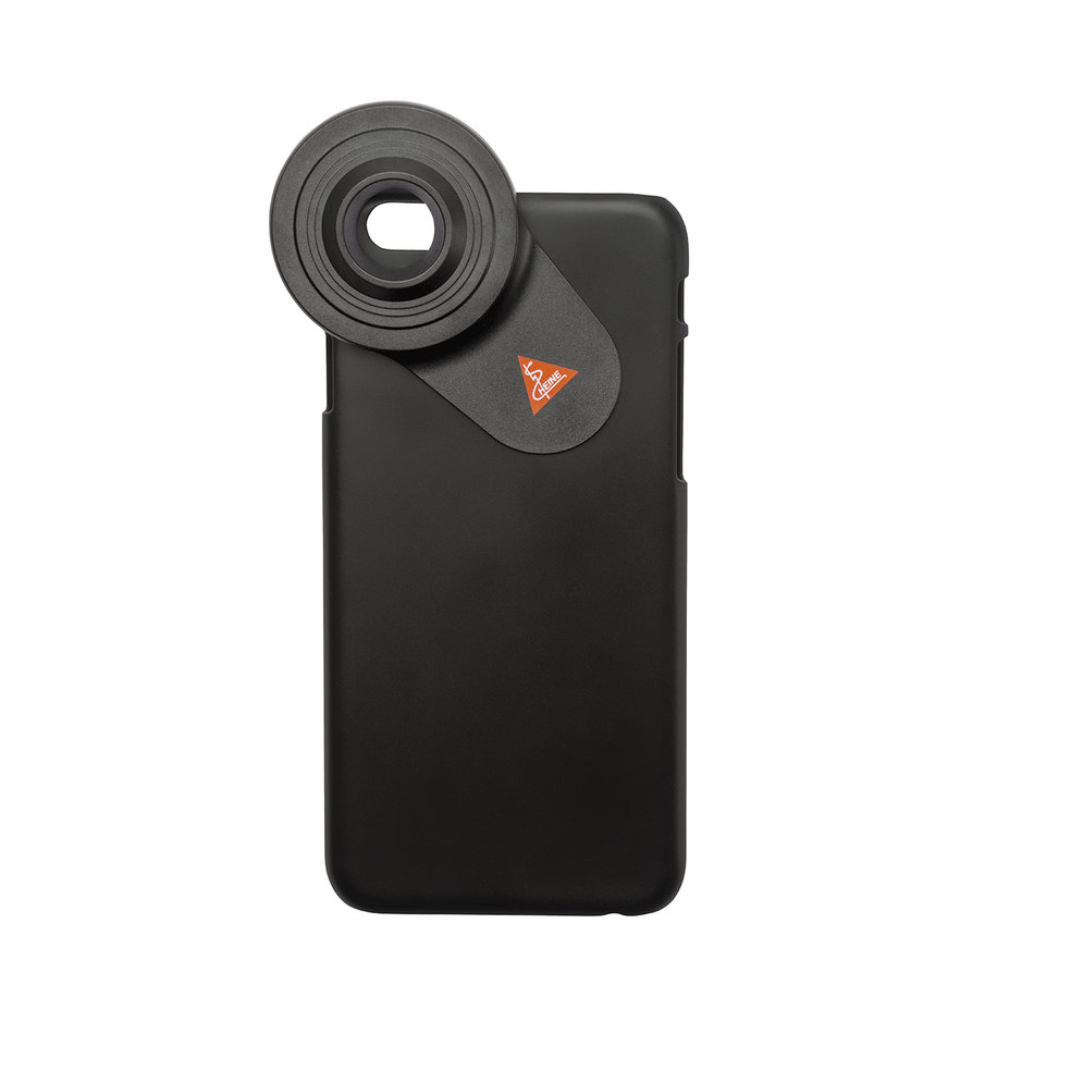 Delta 30 dermatoscope smartphone adapter case